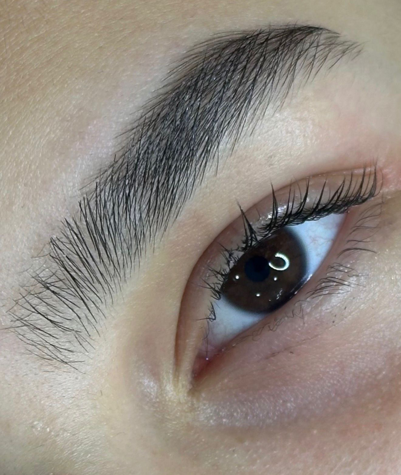 Tratamento para Acne